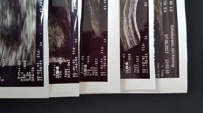 Wie mist echo-foto's? Ze vlogen over de stoep in Schuytgraaf