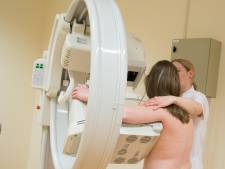 ‘Tientallen extra doden door verschuiven borstkankeronderzoek naar eens in de drie jaar’