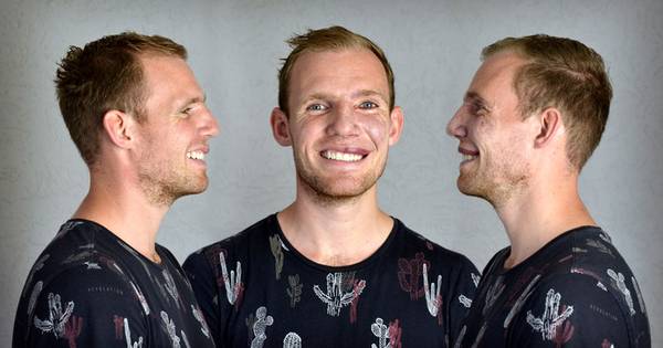 Thijs liet de grote wijnvlek op zijn gezicht weg tatoeëren - Tubantia