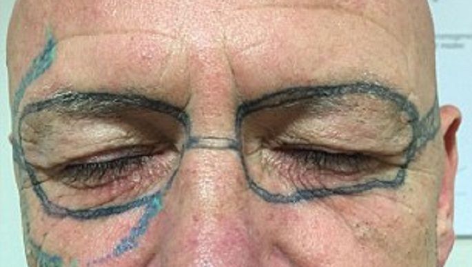 Man Wordt Wakker Met Getatoeeerde Bril Op Gezicht Buitenland Ad Nl