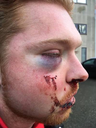 Dader(s) zware mishandeling Eindhoven spoorloos: 'Het is een puzzel'