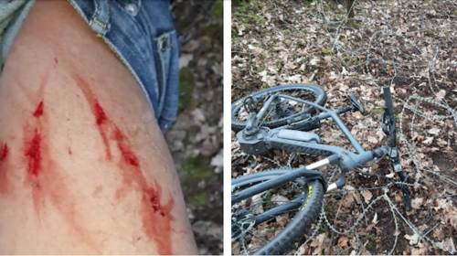 Levensgevaarlijke prikkeldraad heeft mountainbiker beet