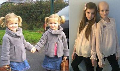 Megan (11) heeft kankersymptomen,  maar haar identieke tweelingzus blijkt ziek