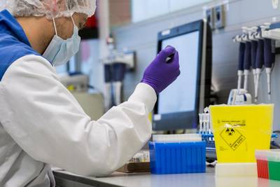 NFI wil meer misdaadzaken: politie laat kansen liggen om daders te pakken