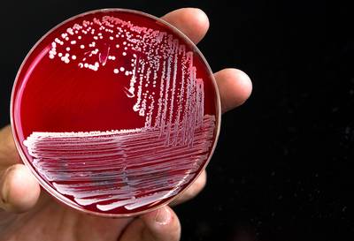 Onderzoek in verband met ziekenhuisbacterie MRSA