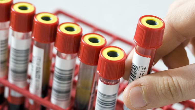 Voor de nieuwe test hoeft alleen een buisje bloed van de moeder te worden afgenomen. Beeld anp