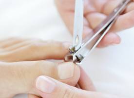 Fijn: zo voorkom je ingegroeide (teen)nagels