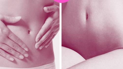 Door onwetendheid over vulva- en vaginakanker blijven veel vrouwen met symptomen rondlopen”