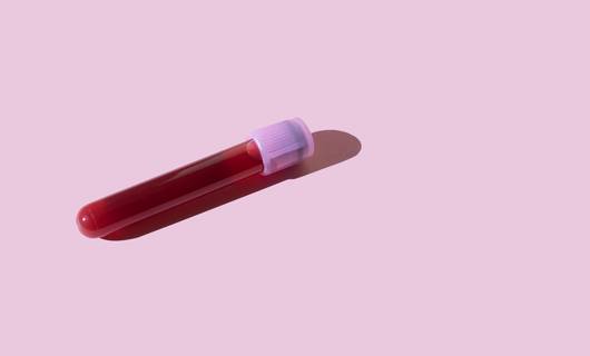 Is het nuttig om elk jaar je bloed te laten checken? Dit zegt de arts: ‘Dit kunnen we er níét in zien’