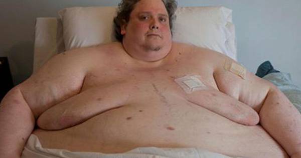 Dikste Man Ter Wereld 445 Kilo Overleden Bizar Ad Nl