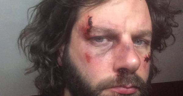 Zanger rockband Bökkers uit Heino krijgt klappen in Utrechtse kroeg - De Stentor