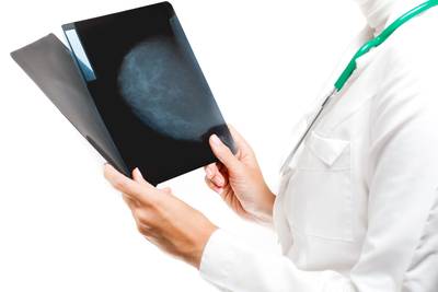 Opnieuw Kamervragen over niet vergoeden MammaPrint