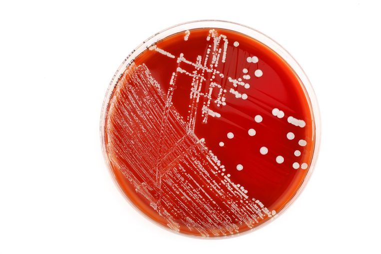 Dit Moet Ons Redden Als Antibiotica Zijn Uitgewerkt De Volkskrant