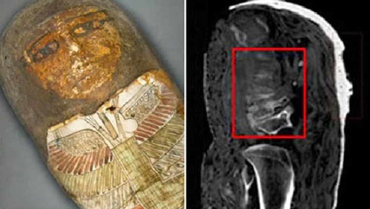 'Twee nepmummies in Vaticaanse Musea' | TROUW - Trouw