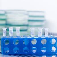 Russische laborant (28) overlijdt nadat reageerbuis met pestbacteriën breekt, 200 mensen in quarantaine