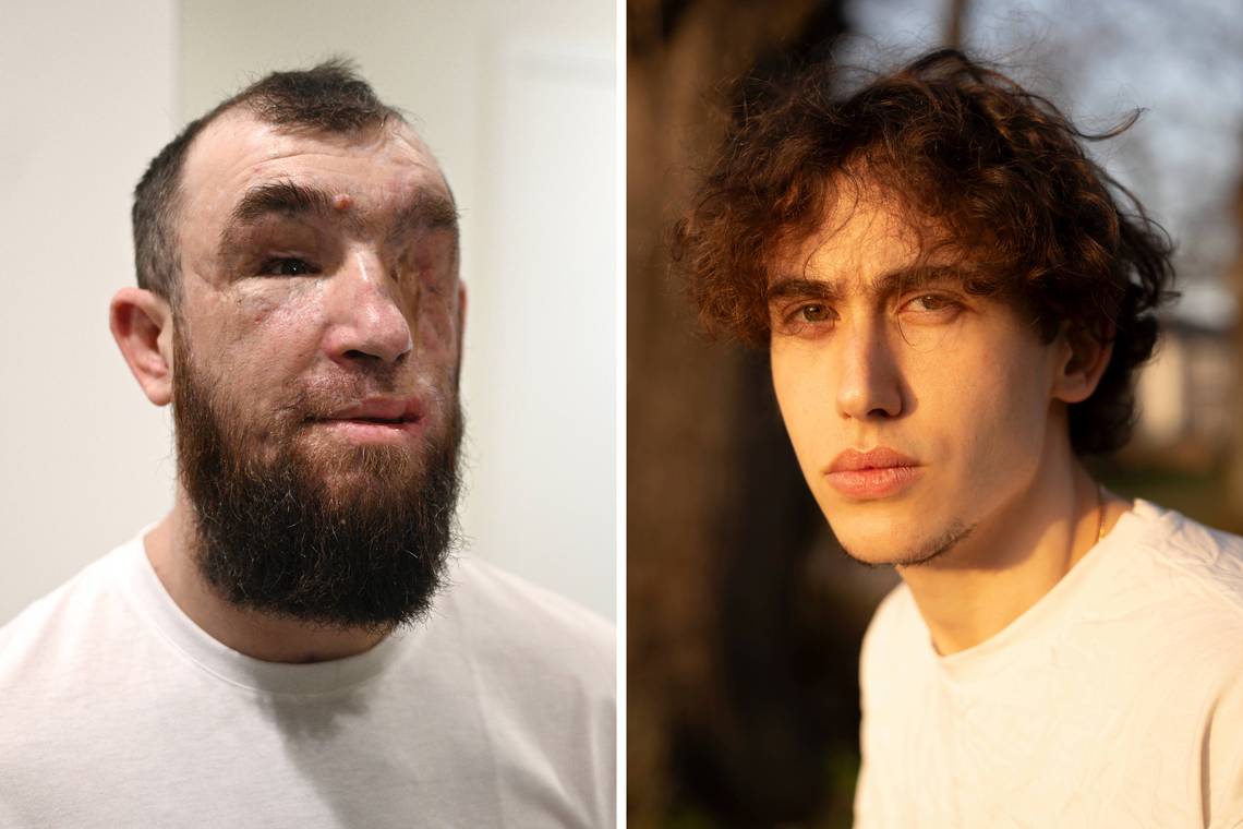 ‘Ik zou me het liefst mijn hele leven verstoppen’: hoe vijf Oekraïners vandaag verder leven met oorlog in hun lijf