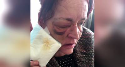 Blind geslagen Jolanda (47) laat kunstoog zien aan dader: 'Dit heb ik door jou!'