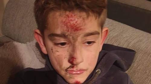 Aanrijdster Leon (9) die wegreed na ongeval is 73-jarige vrouw