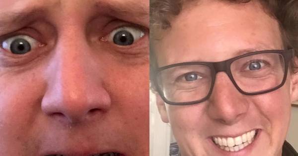 Cabaretier Jochem Meyer Is Geen Beugelbekkie Meer Show Ad Nl