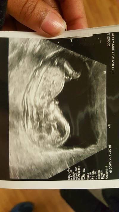 Familie van doodgestoken zwangere vrouw: ‘Baby gaat het waarschijnlijk niet overleven’