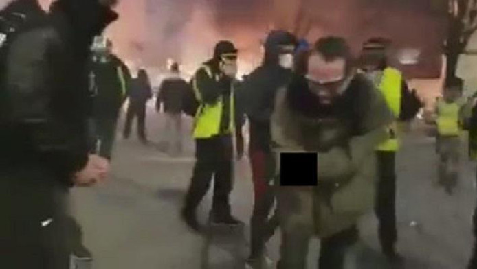 Un Jeune Gilet Jaune à La Main Arrachée Veut Porter