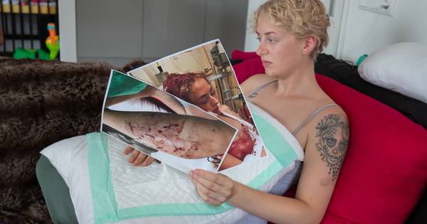 Hond die zwangere vrouw aanviel in Kampen had reputatie van 'killerdog' - AD.nl