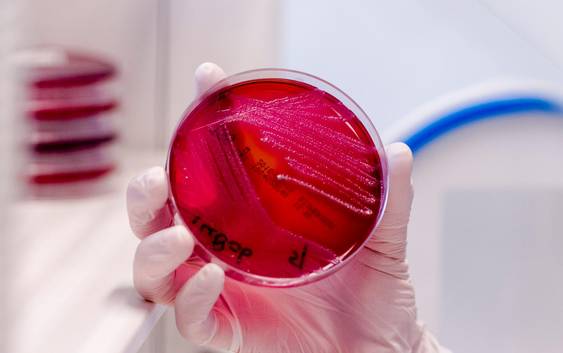 Onderzoek: depressie gelinkt aan bacteriën in de darmen