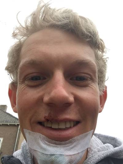 Koen Bouwman lacht tanden weer bloot