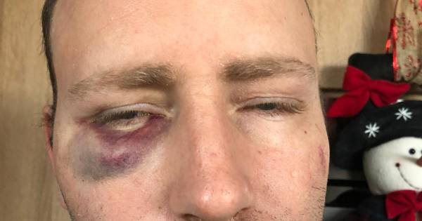 Pakketbezorger Wally klemgereden en in elkaar geslagen: ‘Hij dacht dat ik een middelvinger opstak’