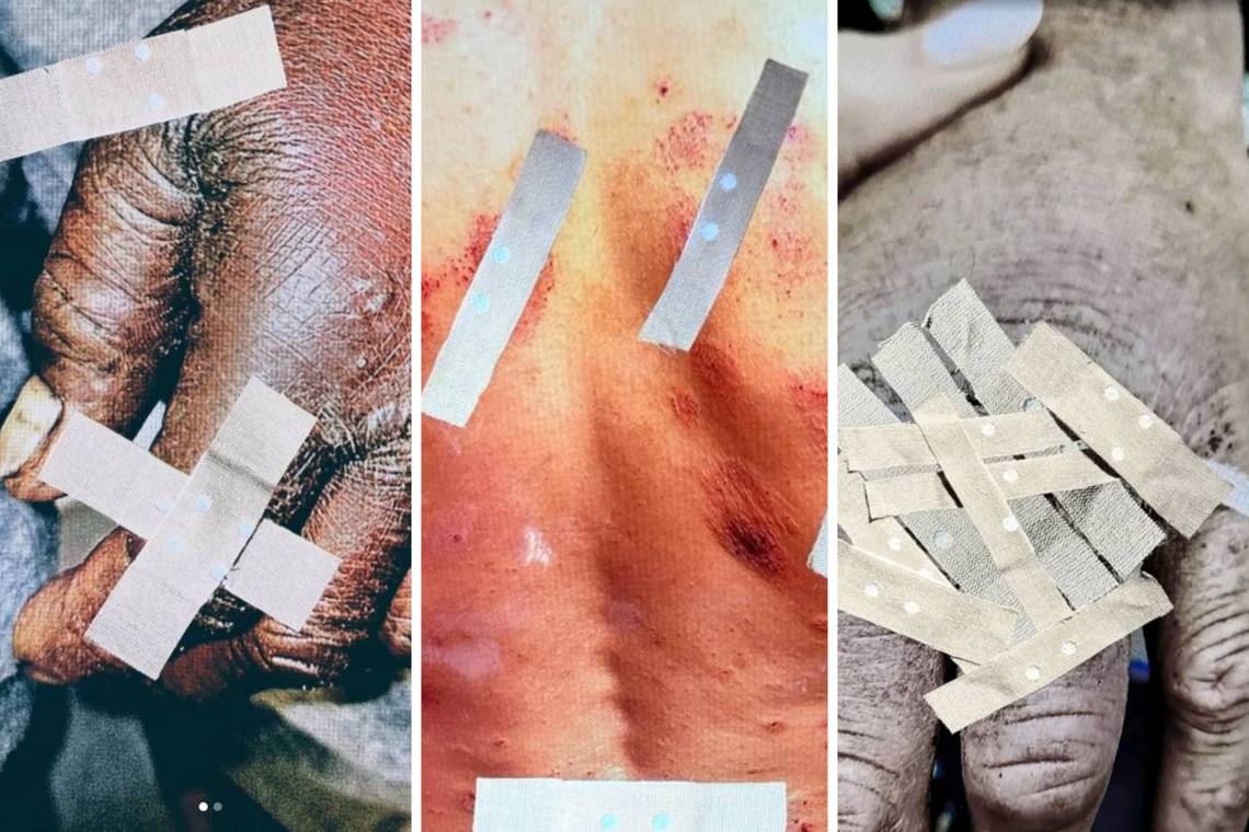 Met deze beelden zet Nederlandse arts het debat over daklozen op scherp: ‘Veel mensen vinden het ongemakkelijk om naar te kijken. Dat begrijp ik’