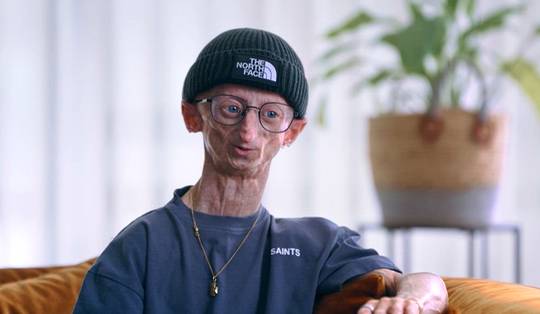 ‘Dat Michiel zo oud is geworden met progeria, wil zeggen dat zijn levenskwaliteit goed ondersteund is geweest’
